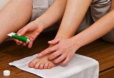 aplikace masti pro léčbu plísní nehtů na nohou